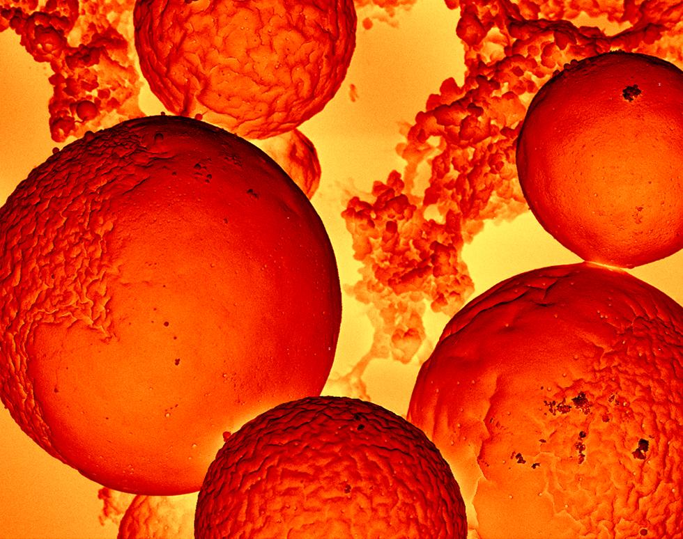 Fireballs - Andrew Treharne